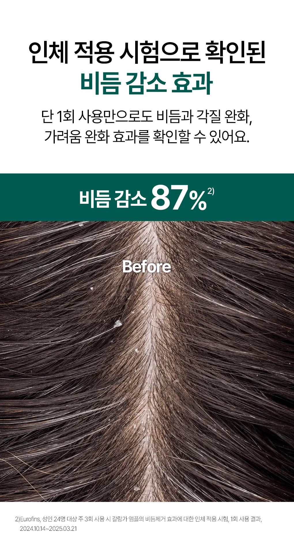 [지루성 두피 & 가려움 케어] 클로란 갈랑가 진저 비듬 앰플 100ml 상세페이지 9